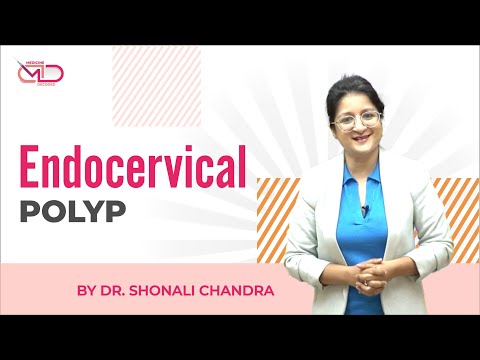 Endocervical Polyp || Medicine Decoded || Obs-Gyne || Dr. Shonali Chandra