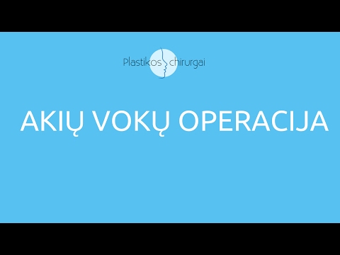 Akių Vokų Pakėlimo Plastikos Operacija ir Korekcija | PlastikosChirurgai.lt