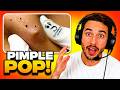 You WON'T Believe What Came Out 😱 | Pimple Popping Reaction
