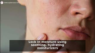 Red Irritated Skin Relief 9 Expert Soothing Remedies