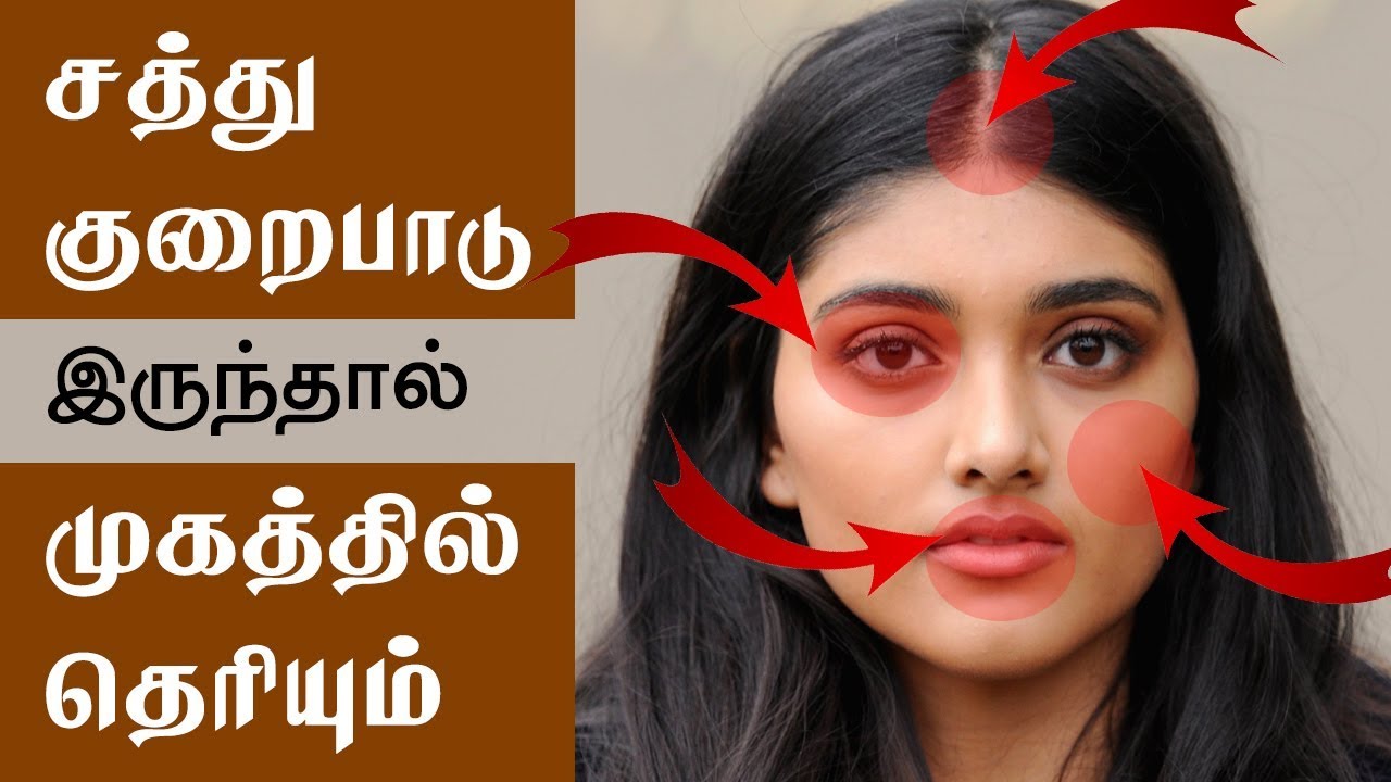 Vitamin Deficiency Symptoms On Your Face And How To Fix Them Tamil