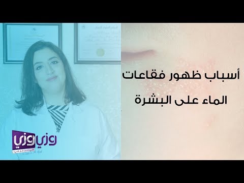 فيديو: هل تحافظ حبوب الماء على رطوبتك؟