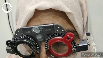 Retinoscopy 7 plus in one and minus in other