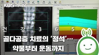 [박광식의 건강365] &#39;골다공증&#39;치료의…