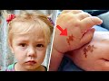 Mom Adopts Girl With Same Birthmark - She Screams When She Sees DNA Test Results