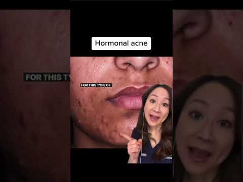 Video: Valeratul de betametazonă ajută la acnee?
