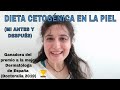 DIETA CETOGÉNICA en la PIEL  "MI ANTES y DESPUÉS" (1º Parte)