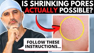 The REAL Truth About Shrinking Your Pores and what to do about them.