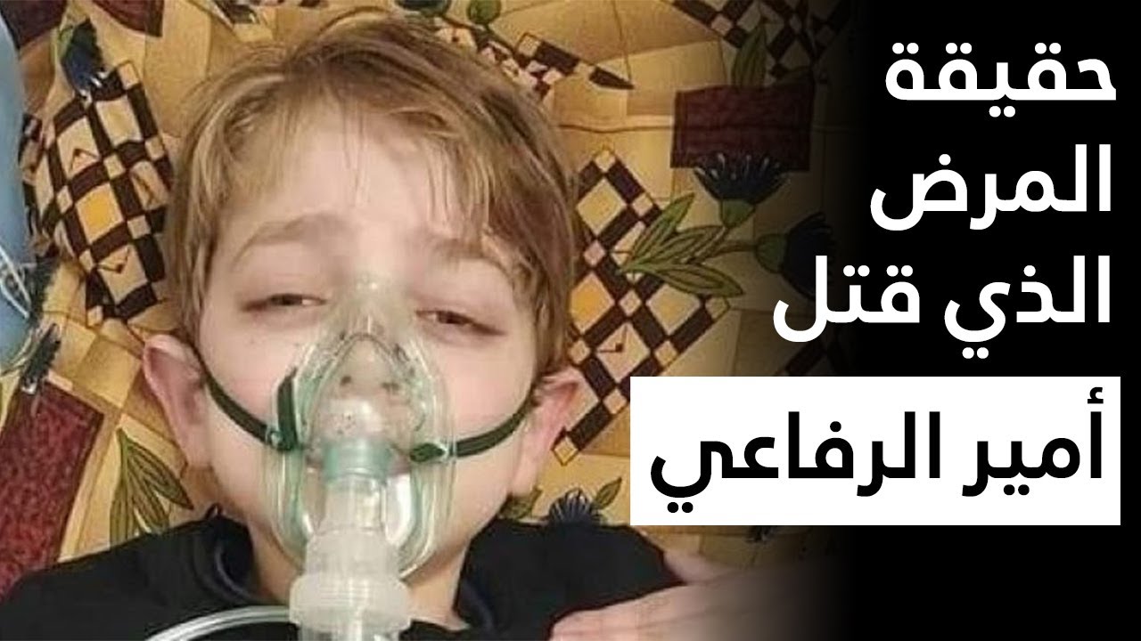 خسرنا أمير الرفاعي | حقيقة مرض التليف الكيسي