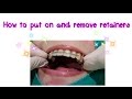 How to put on and remove retainer