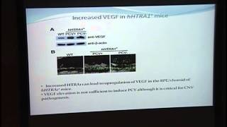 HTRA1 & Age Related Macular Degeneration [ARCHIVE]