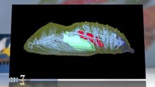 Inside the Cocoon: 3-D Views of a Butterfly's Metamorphosis
