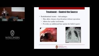 Current Strategies for Managing the Perforated Esophagus