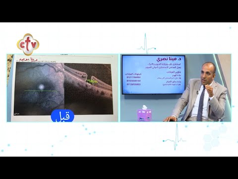 الليزيك والشبكية مع الدكتور مينا نصري صحتك 15 11 2025