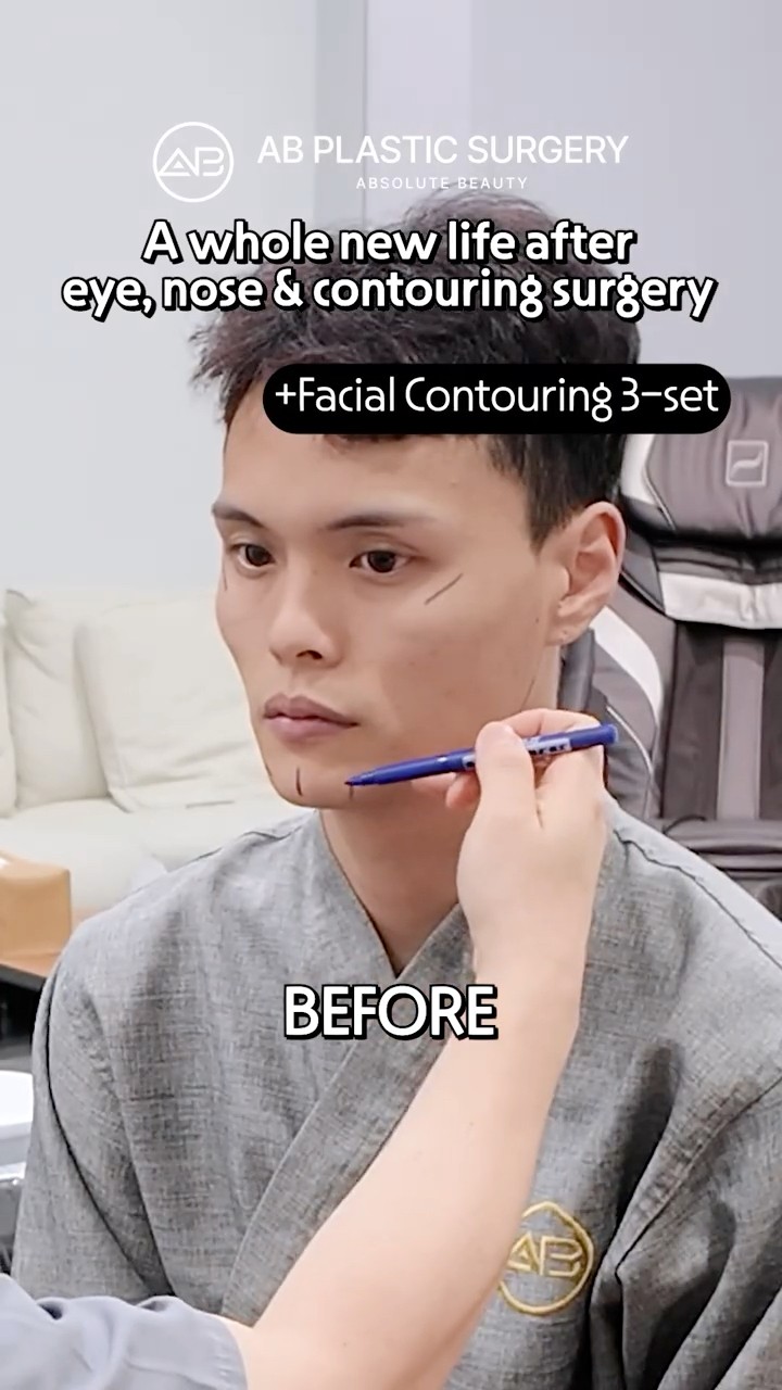 This Facial Surgery Changed His Whole Look #shorts