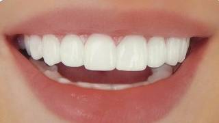 perfect teeth + beautiful smile subliminal [extremely powerful]