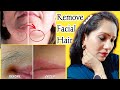 How to Remove Facial Hair Permanently💯%🌿 FACIAL HAIR REMOVAL HOME REMEDY | Remove Unwanted Hair