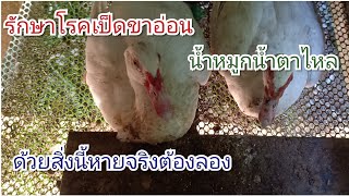 รักษาโรคเป็ดขาอ่อน,น้ำหมูกน้ำตาไหลหาย!!!ด้วยสิ่งนี้