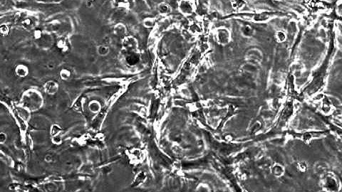 Capillary-like Network Formation of iCell® Endothelial Cells in PEG Hydrogel