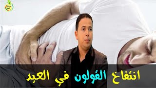 أسباب انتفاخ القولون العصبي في أيام العيد  -  الدكتور محمد أحليمي  -