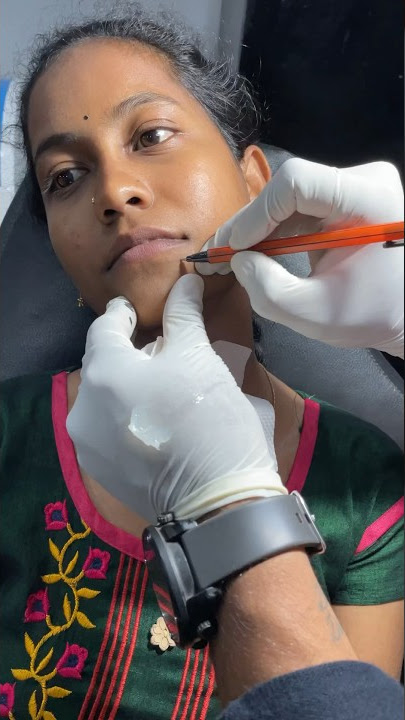 MOLE TATTOO ☎️9848312719 #hyderabad #trending #viral #youtubeshorts #viralvideo #support #subscribe