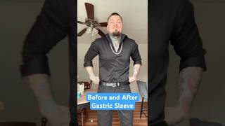 Before and After Gastric Sleeve!! 🔥