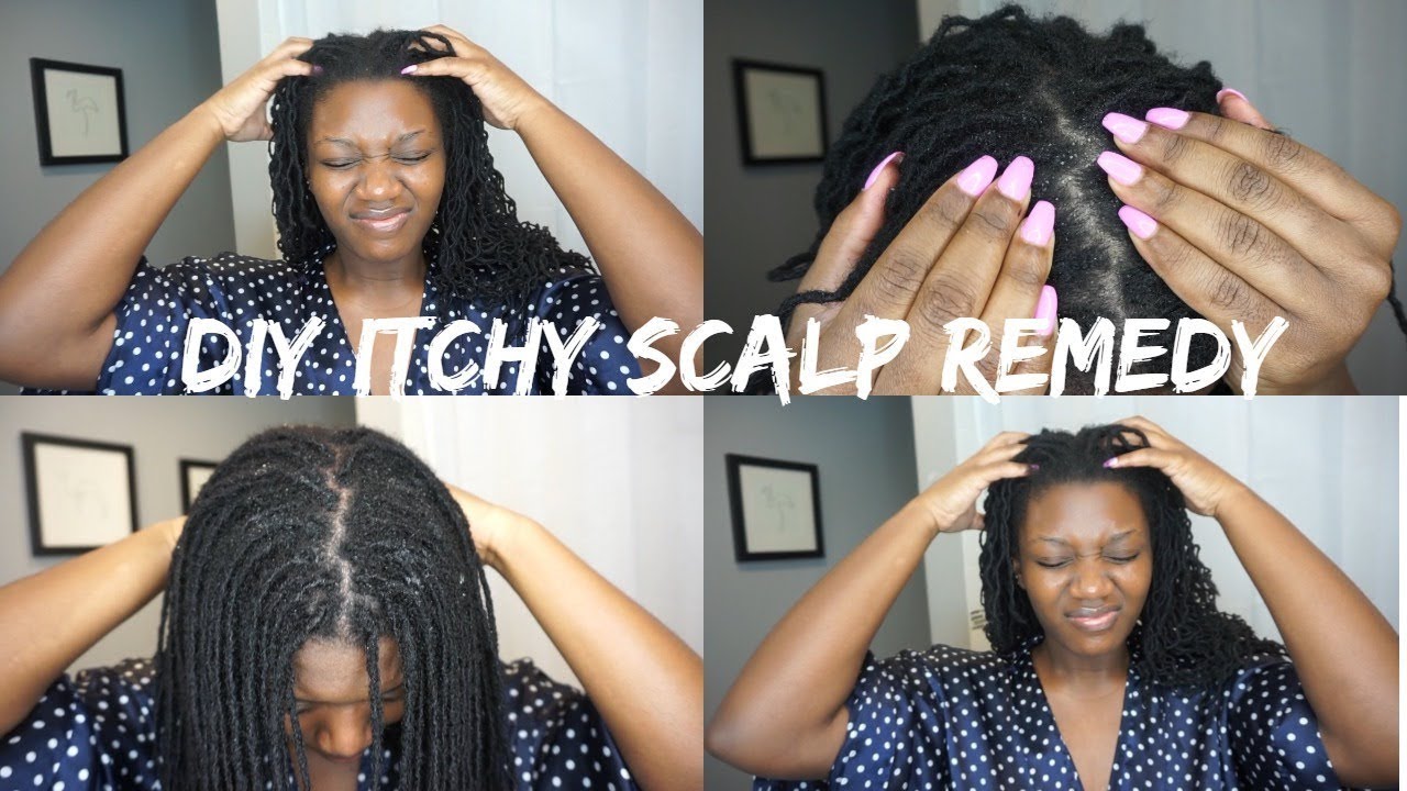 Best Diy Itchy Scalp Overnight Best Diy Itchy Scalp Overnight
