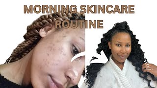This is my morning skincare routine as a girl who has hormonal acne.