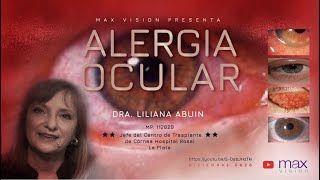 Alergia Ocular  Dra. Liliana Abuin