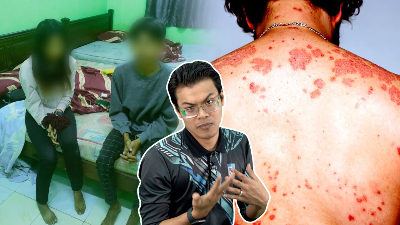 Buat Benda Ini Bila Kena HIV