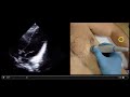Optimizing Cardiac Views with Ultrasound