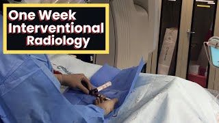 One Week In Interventional Radiology - Day in the Life by TheRadMed 787 views 2 years ago 15 minutes
