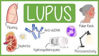 Systemic Lupus Erythematosus in 3 Minutes