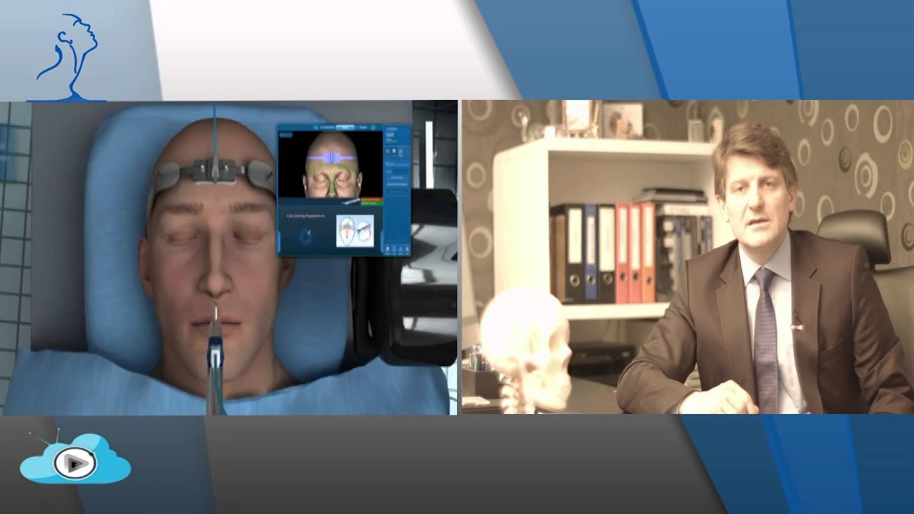 Doç. Dr. Teoman Dal - KBB Uzmanı - Sinüzit Ameliyatında Cerrahi Navigasyon Nedir? Nasıl Uygulanır?