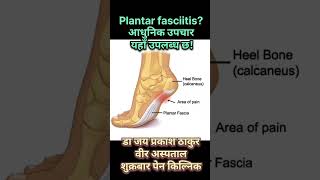 heel pain plantar fasciitis PRP injection