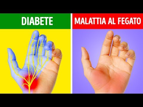 Video: Cosa Fare Quando Le Mani Sono Basse