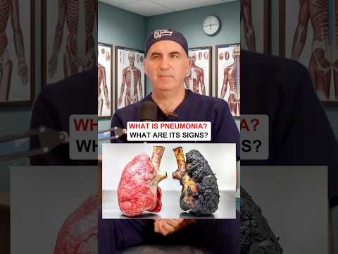 Lungs cancer #health #doctor #lungs #backpain #viral #plasticsurgeon #scapulapain #tips #dentist 🫁