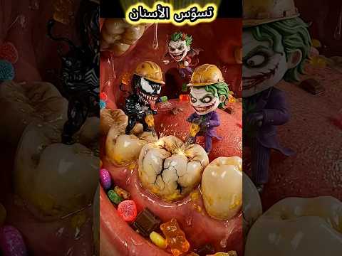 سبايدرمان الصغير يواجه وحوش التسوس سبايدرمان