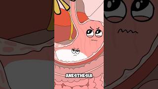 Why You Can’t Eat Before Surgery #animation  #funny  #shorts