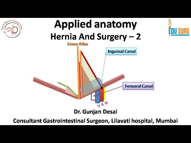 Inguinal (Hesselbach's) Triangle - Borders - Direct Hernia - TeachMeAnatomy