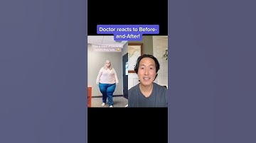 Incredible Weight Loss Journey! #shorts #weightloss