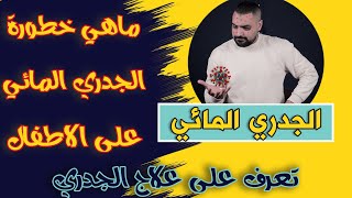 الجدري المائي عند الأطفال |وايه مضاعفاته وايه علاجه