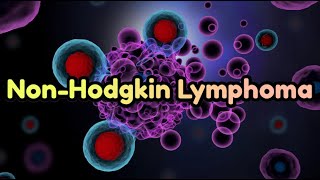 Non-Hodgkin Lymphoma (updated 2023) - CRASH! Medical Review Series