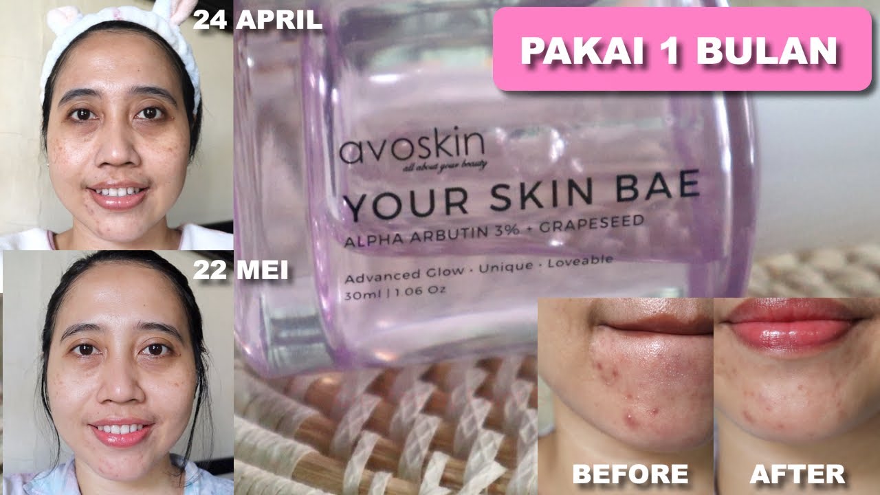 Avoskin ysb alpha arbutin