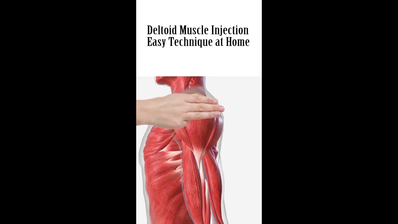 How To Give An Intramuscular IM Injection In Deltoid Muscle Shoulder Easily At Home