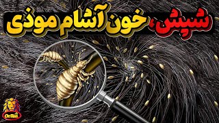 شپش‌ انگلی خارجی که چاره ای جززندگی روی بدن یک جاندارندارد