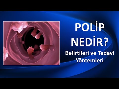 POLİP NEDİR?