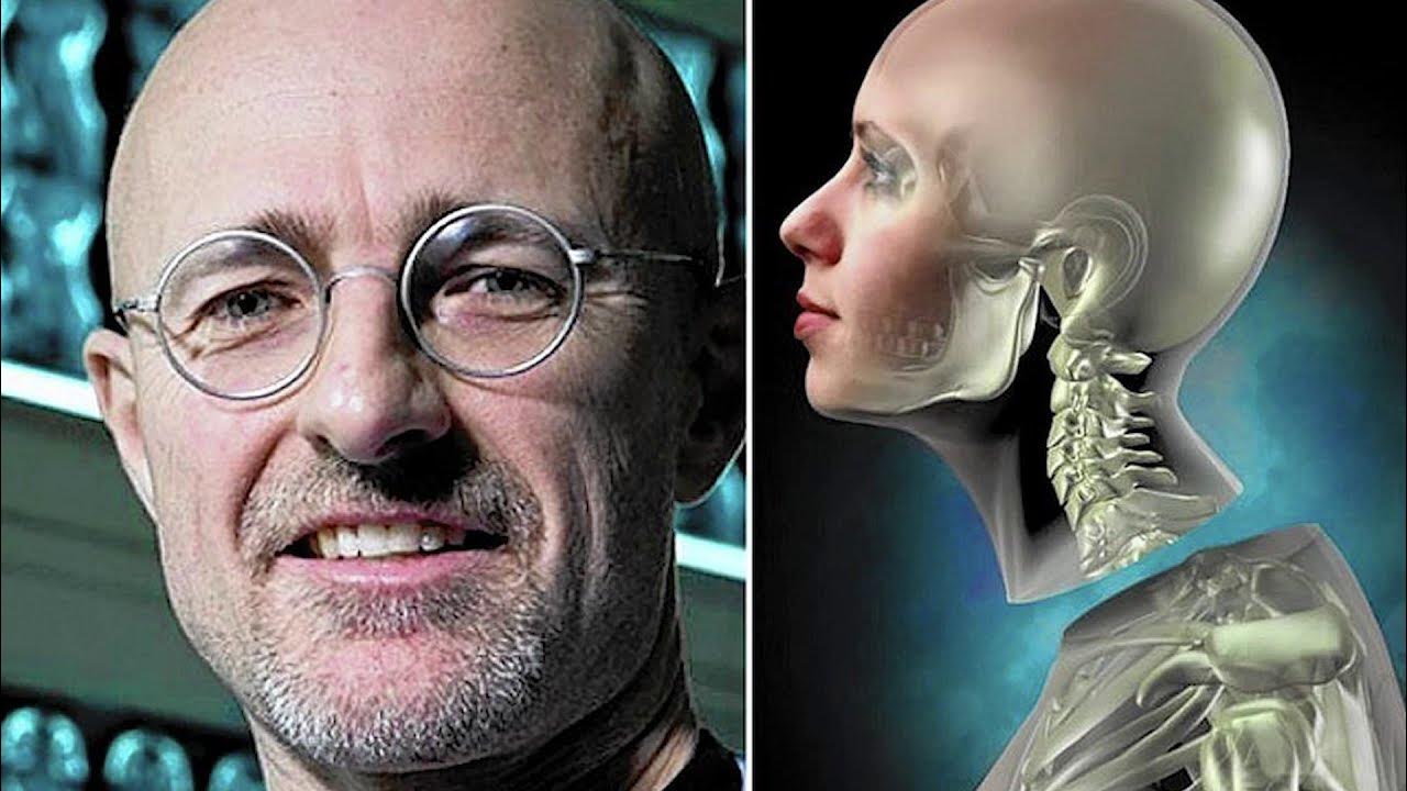 What Happened to the First Human Head Transplant? YouTube