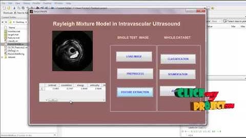 Final Year Projects | Rayleigh mixture model for plque character in IVUS