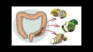 مريض بالقولون أهدر 60 ألفًا على الأدوية وشفي بريال واحد فقط !